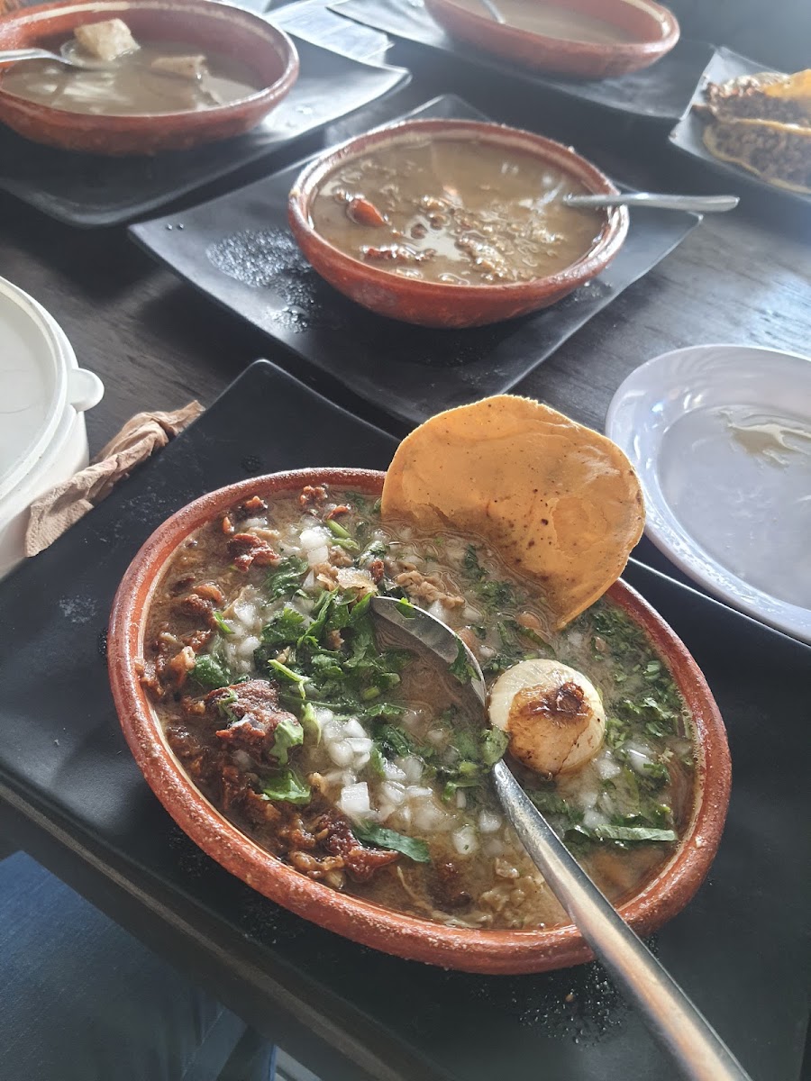 Carne En Su Jugo 'el Sheko De La Torre' Photo 8